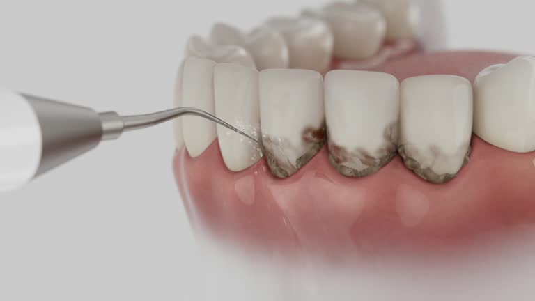 Reliable Emergency Dentist contractor in Wright, WY by Smile Center Dentistry